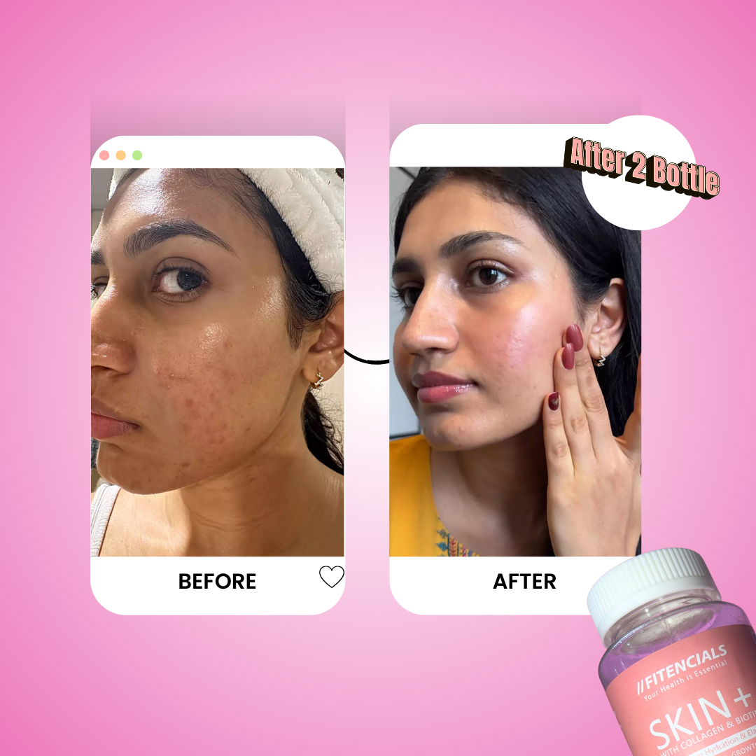 Skin Gummies with Collagen