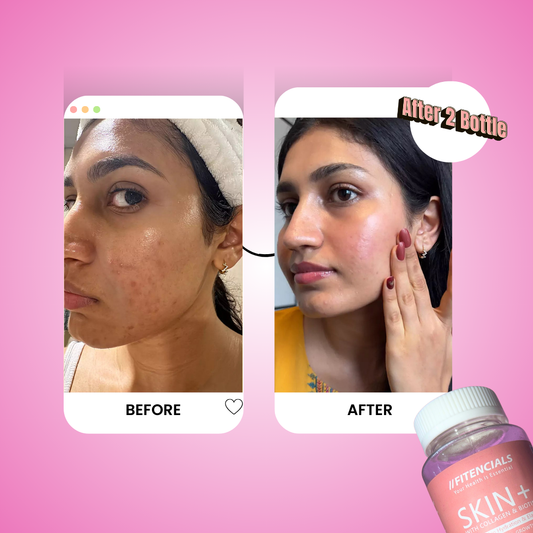 Skin Gummies with Collagen